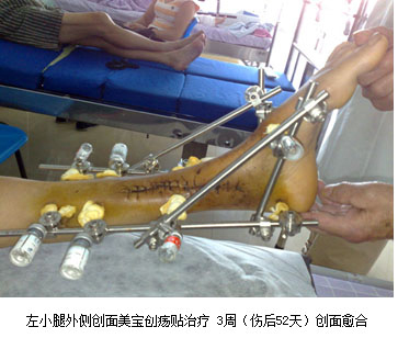 bevictor伟德官网-韦德官方网站